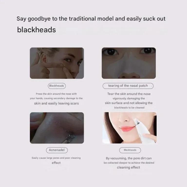 دستگاه میکرودرم شیائومی inFace مدل MS7000 image gallery