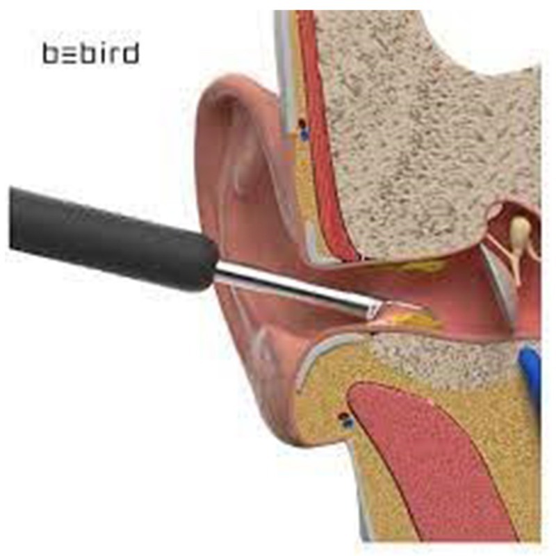 گوش پاک‌کن هوشمند شیائومی Bebird  مدلR1 image gallery