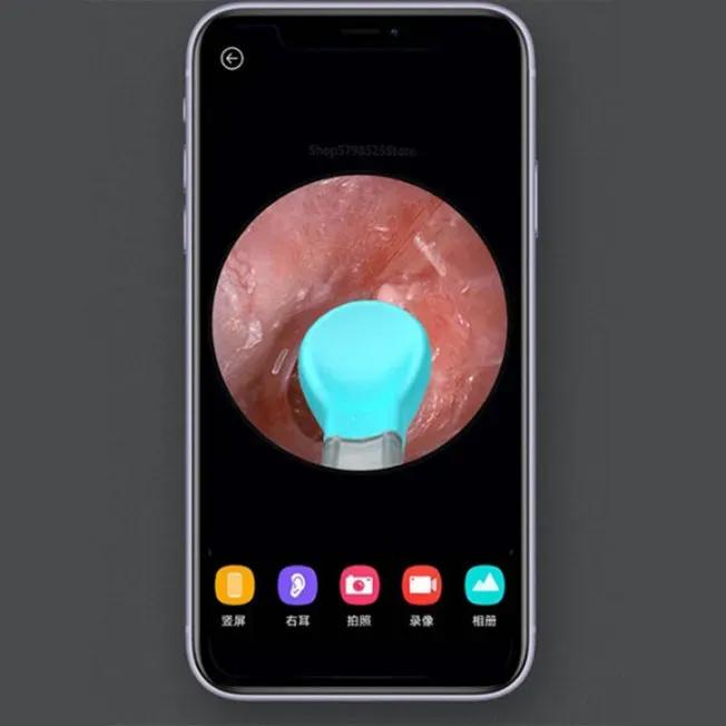 گوش پاک‌کن هوشمند شیائومی BEBIRD مدل M9 Pro image gallery